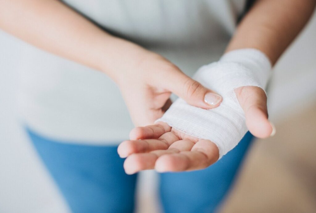 Dog bite lawsuit